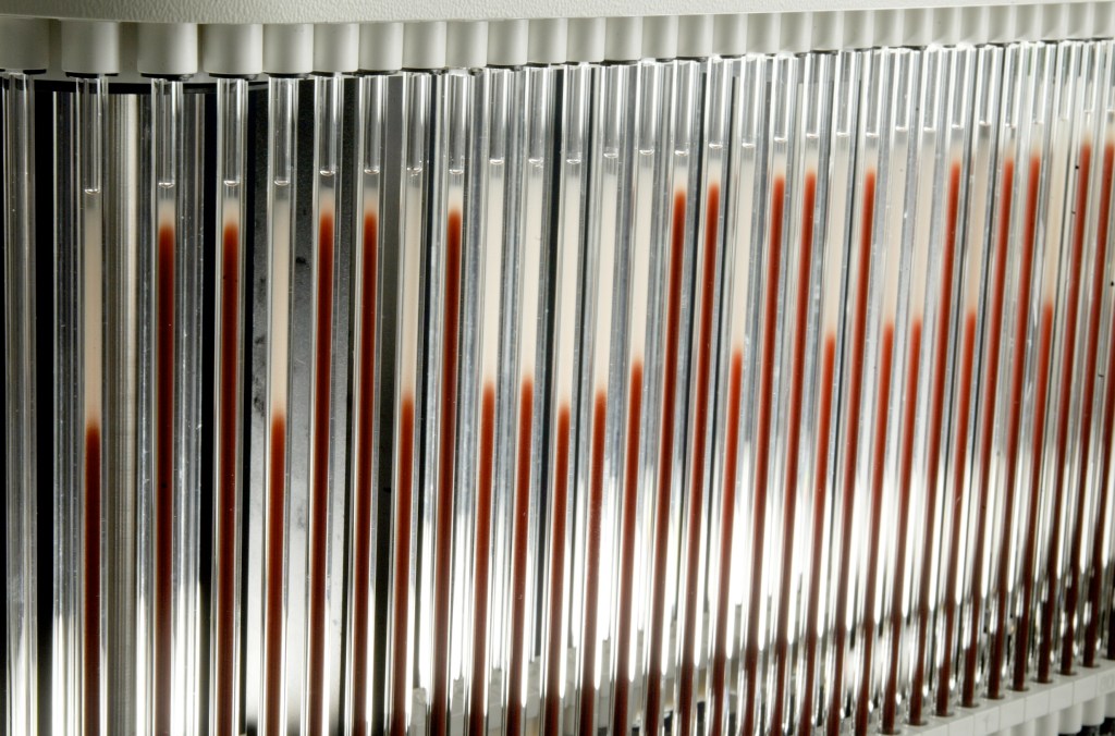 紅血球沉降速率在標準實驗室的做法